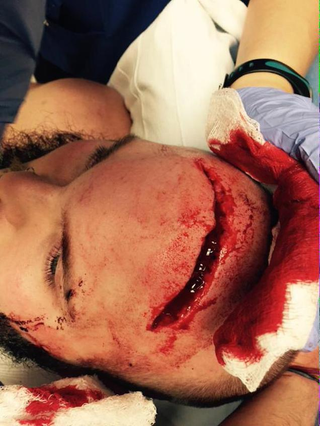 Illustration for article titled Look At This Wrestler's Gross Head Wound, Or Don't. Do What You Want.